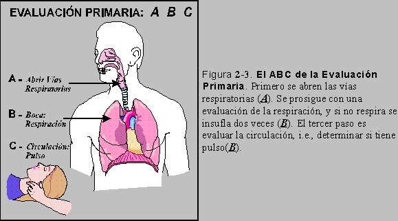 El complejo de los ejercicios por los ejercicios físicos a la escoliosis
